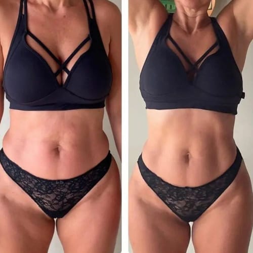Customer photo - Anja H., belly before and after