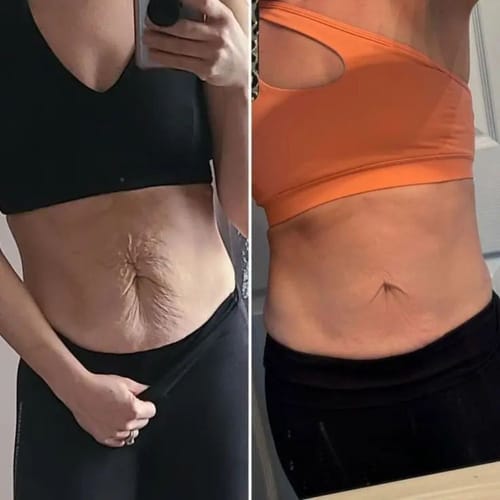 Customer photo - Alicia D., belly before and after