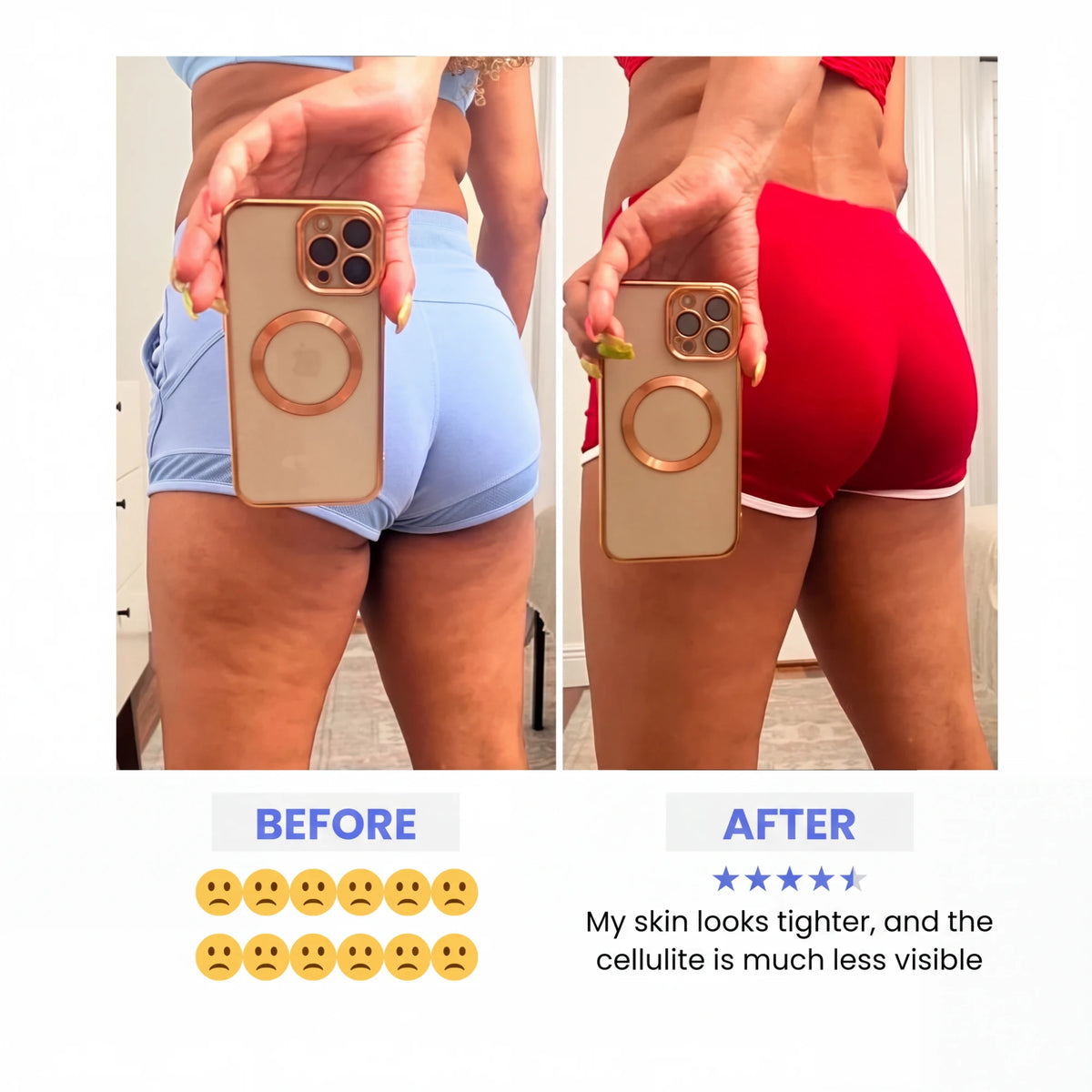 Before and after: skin looks tighter and cellulite is much less visible